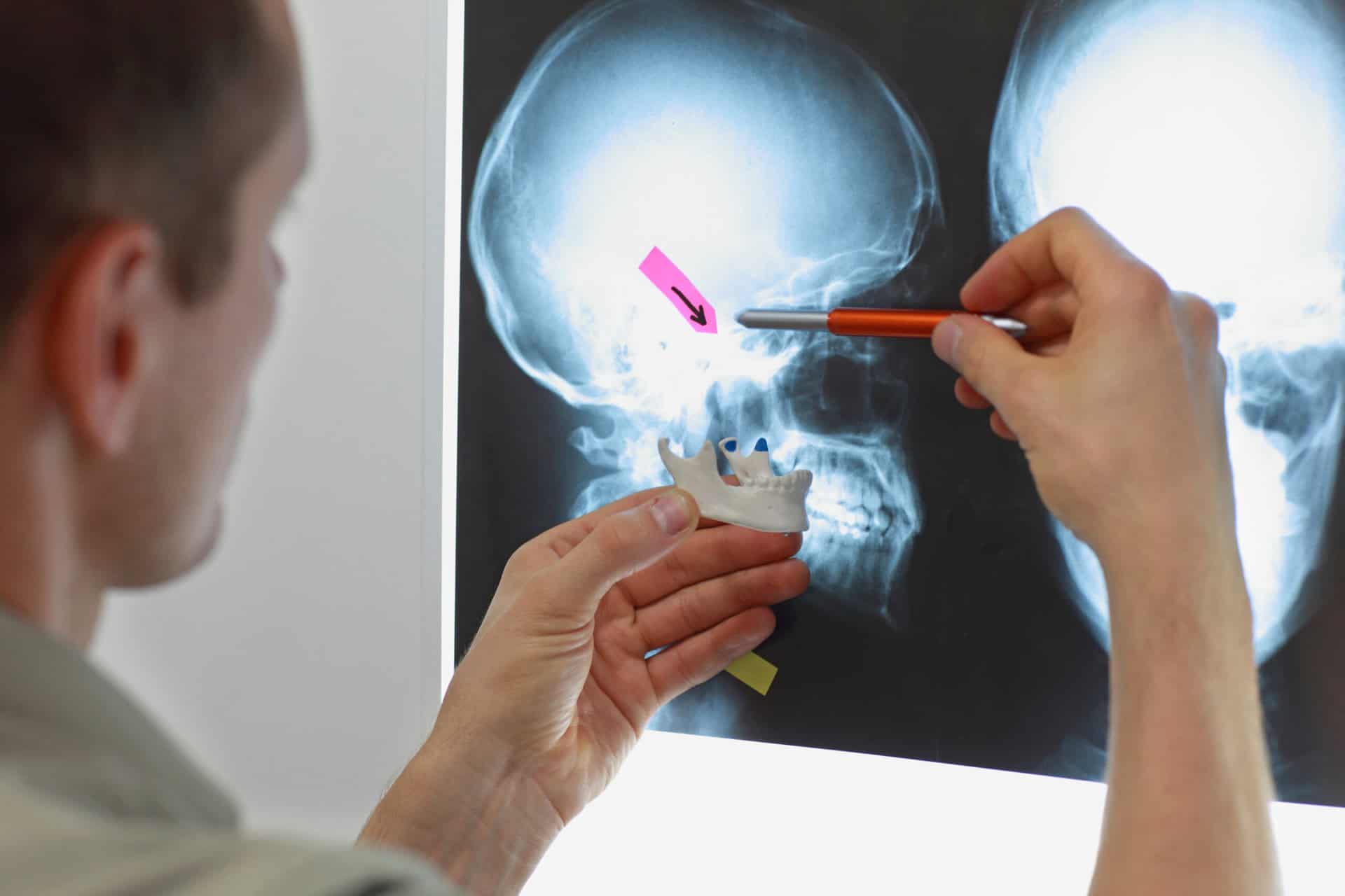 Professional with model of lower jaw watching images of skull at x-ray film viewer. Diagnosis,treatment planning
